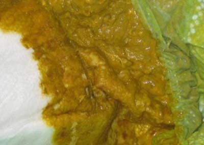 مدفوع نوزاد,انواع مدفوع نوزاد,مدفوع واقعی نوزاد